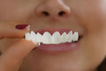 Instant Smile Perfection: Natural-Look Clip-On Cosmetic Veneers