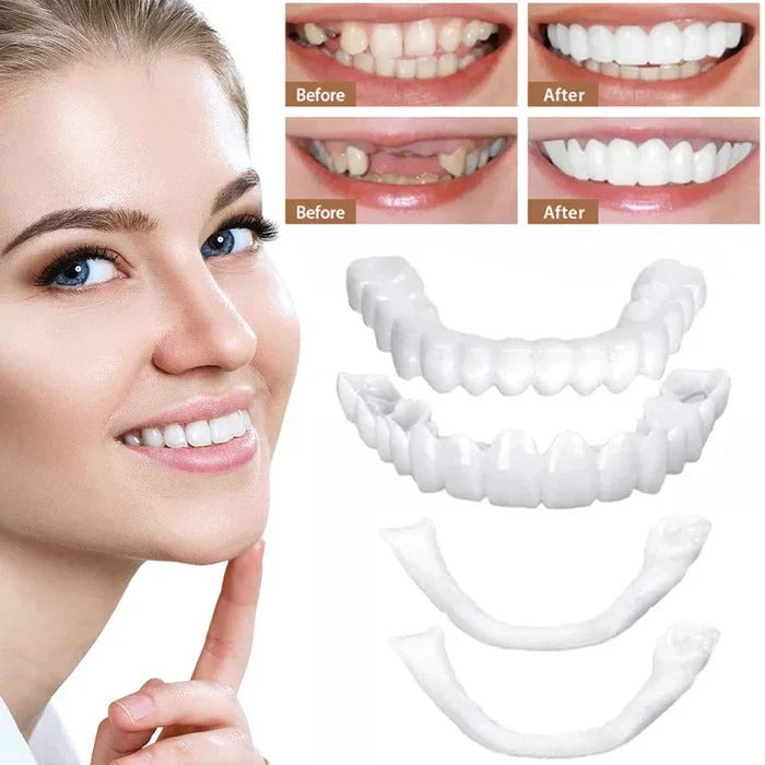 Instant Smile Perfection: Natural-Look Clip-On Cosmetic Veneers