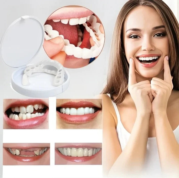 Instant Smile Perfection: Natural-Look Clip-On Cosmetic Veneers